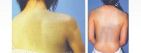 Treatment illustration
